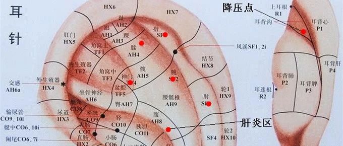 【针灸】针刺降压十法：10秒降压