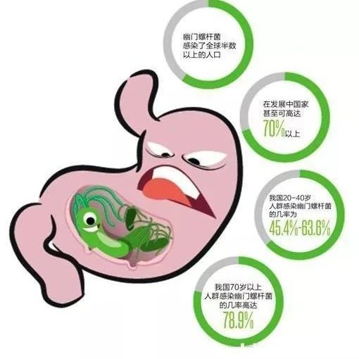 胃病的元凶幽门螺旋杆菌，3个方法能灭了它！